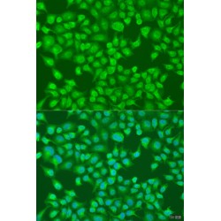 Acyl Coenzyme A Oxidase 1, Palmitoyl (ACOX1) Antibody