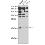 Western blot analysis of extracts of various cell lines using CST1 Antibody (1/1000 dilution).