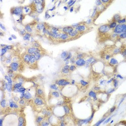 Pancreatic Triacylglycerol Lipase (PNLIP) Antibody