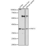 Western blot analysis of extracts of various cell lines using PHF11 Antibody (1/1000 dilution).