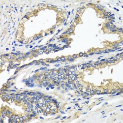 Electron Transfer Flavoprotein Alpha Polypeptide (ETFA) Antibody