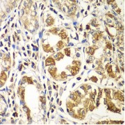 Immunohistochemistry of paraffin-embedded Human gastric using RAC1 Antibody (1/100 dilution, 40x lens).