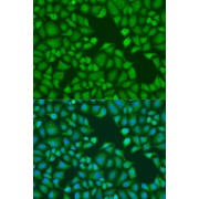 Immunofluorescence analysis of U2OS cells using TNRC6A Antibody (1/100 dilution). Blue: DAPI for nuclear staining.