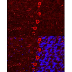 Inositol 1,4,5-Trisphosphate Receptor Type 1 (ITPR1) Antibody