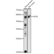 Western blot analysis of extracts of various cell lines using SOX1 Antibody (1/1000 dilution).