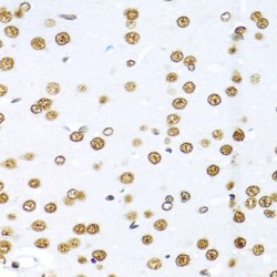 GAP-Associated Tyrosine Phosphoprotein P62 (KHDRBS1) Antibody