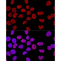 GAP-Associated Tyrosine Phosphoprotein P62 (KHDRBS1) Antibody