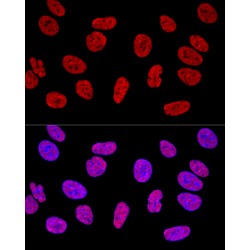 GAP-Associated Tyrosine Phosphoprotein P62 (KHDRBS1) Antibody