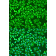 Immunofluorescence analysis of U2OS cells using DVL2 Antibody (1/100 dilution). Blue: DAPI for nuclear staining.