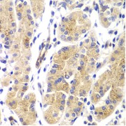 Immunohistochemistry of paraffin-embedded Human gastric using HRas Antibody (1/100 dilution, 40x lens).