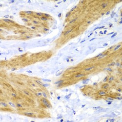 GTPase HRas (HRAS) Antibody