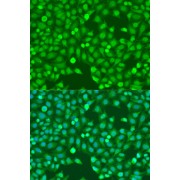 Immunofluorescence analysis of U2OS cells using MEF2A Antibody (1/100 dilution). Blue: DAPI for nuclear staining.