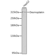 Western blot analysis of extracts of HepG2 cells using Desmoplakin Antibody (1/800 dilution).