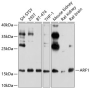 Western blot analysis of extracts of various cell lines using ARF1 Antibody (1/1000 dilution).