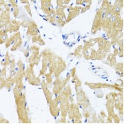 Immunohistochemistry of paraffin-embedded Rat heart using GLUT4 Antibody (1/100 dilution, 40x lens).