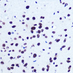 Serum Response Factor (SRF) Antibody