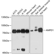 Western blot analysis of extracts of various cell lines using AMPD1 Antibody (1/3000 dilution).