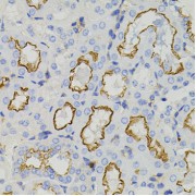 Immunohistochemistry of paraffin-embedded Mouse kidney using STX1A Antibody