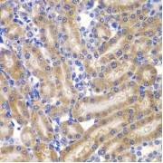 Immunohistochemistry of paraffin-embedded Rat kidney using SHC1 Antibody (1/100 dilution, 40x lens).