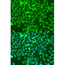 SHC-Transforming Protein 1 (SHC1) Antibody