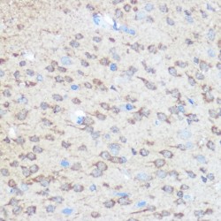 Huntingtin (HTT) Antibody