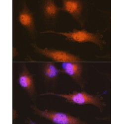 Huntingtin (HTT) Antibody