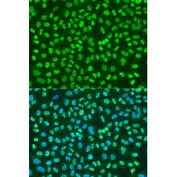 Polypyrimidine Tract-Binding Protein 1 (PTBP1) Antibody