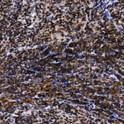 TH1-Like (Drosophila) (TH1L) Antibody