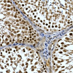 TH1-Like (Drosophila) (TH1L) Antibody