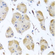 Immunohistochemistry of paraffin-embedded Human stomach using MYLK Antibody (1/100 dilution, 40x lens).