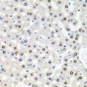 Immunohistochemistry of paraffin-embedded Rat liver using U2SURP Antibody (1/100 dilution, 40x lens).