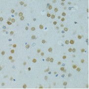 Immunohistochemistry of paraffin-embedded Rat brain using MUS81 Antibody (1/100 dilution, 40x lens).