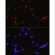 Immunofluorescence analysis of Y79 cells using Rb Antibody (1/100 dilution, 40x lens). Blue: DAPI for nuclear staining.