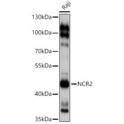 Western blot analysis of extracts of Raji cells using NCR2 Antibody (1/1000 dilution).