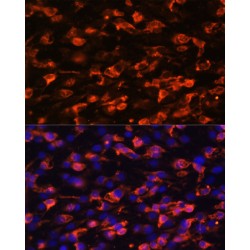 Phosphoinositide-3-Kinase Class-2-Alpha Polypeptide (PIK3C2A) Antibody