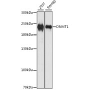 Western blot analysis of extracts of various cell lines using DNMT1 Antibody (1/1000 dilution).