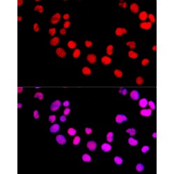 DNA Methyltransferase 1 (DNMT1) Antibody