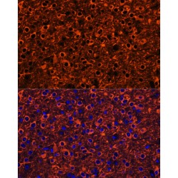 Tubulin Beta 3 (TUBB3) Antibody