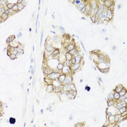 Immediate Early Response 3 (IER3) Antibody