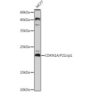 Western blot analysis of extracts of MCF7 cells using CDKN1A/P21cip1 Antibody (1/1000 dilution).