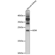 Western blot analysis of extracts of Mouse kidney using ADM Antibody (1/1000 dilution).