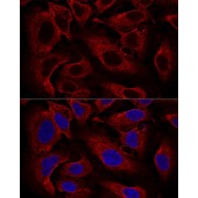 Confocal immunofluorescence analysis of U2OS cells using ARL8B Antibody (1/100 dilution). Blue: DAPI for nuclear staining.