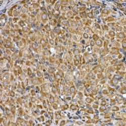 Insulin-Induced Gene 2 Protein (INSIG2) Antibody