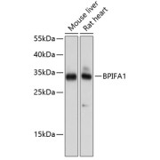 Western blot analysis of extracts of various cell lines using BPIFA1 Antibody (1/1000 dilution).