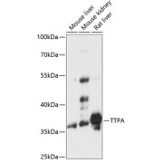 Western blot analysis of extracts of various cell lines using TTPA Antibody (1/3000 dilution).