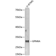 Western blot analysis of extracts of U-87MG cells using GPM6A Antibody (1/1000 dilution).