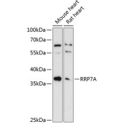 Western blot analysis of extracts of various cell lines using RRP7A Antibody (1/3000 dilution).