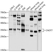 Western blot analysis of extracts of various cell lines using CNOT7 Antibody (1/1000 dilution).