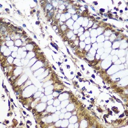 CCR4-NOT Transcription Complex Subunit 7 (CNOT7) Antibody