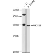 Western blot analysis of extracts of various cell lines using PHOX2B Antibody (1/1000 dilution).